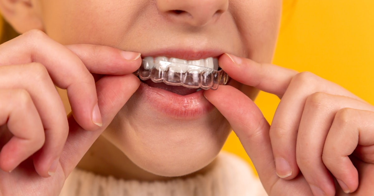 Plano Odontológico: Como Escolher o Melhor em 2026 e Economizar nos Tratamentos